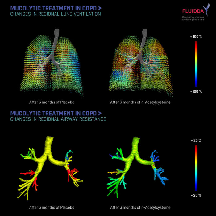 Mucus in COPD