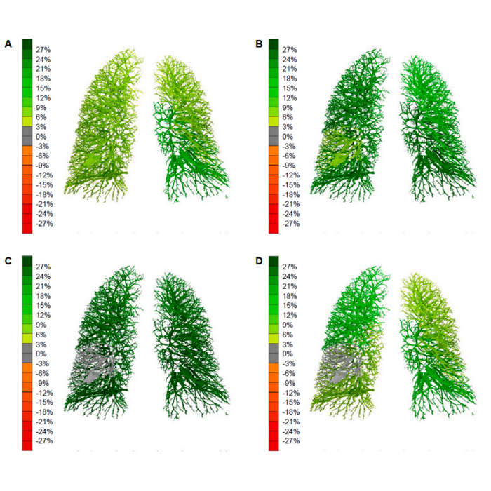 FRI technology showed substantial and homogeneous vasodilation during phase one research for new PAH medication.